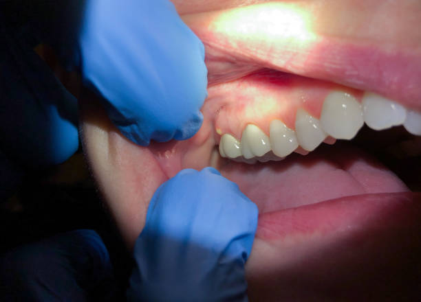 Best After-Hours Dental Trauma Care in Blue Ridge, VA