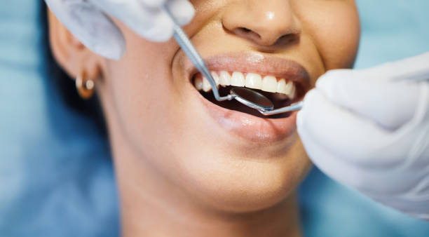 Best After-Hours Dental Trauma Care in Blue Ridge, VA